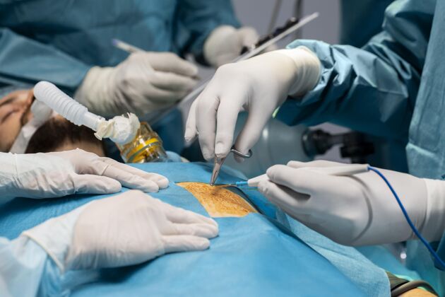诊所医生在给病人做外科手术健康过程植入