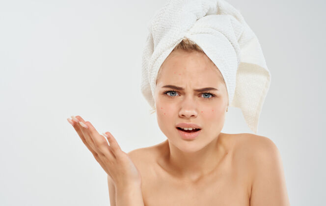 青春痘女人用毛巾在她的头上赤裸的肩膀湿头发的问题 我们面对的皮肤护理身体清洁