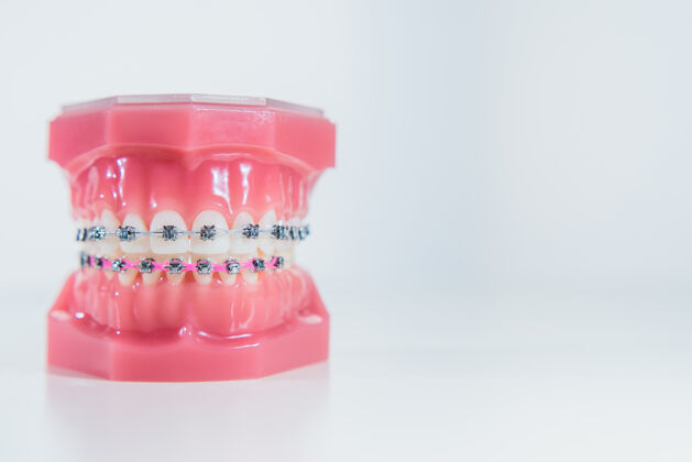 清洁牙套放在白色表面上的假牙上牙齿支架医疗