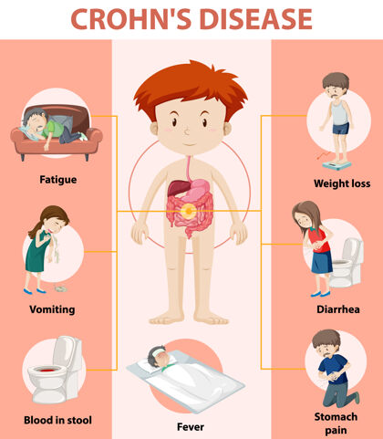 人物克罗恩病的医学信息图不健康儿童胃