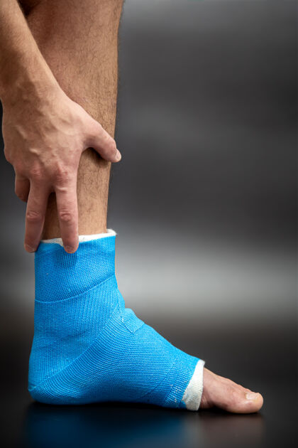 脚跟脚蓝色夹板治疗踝关节扭伤的特写镜头关闭石膏骨折